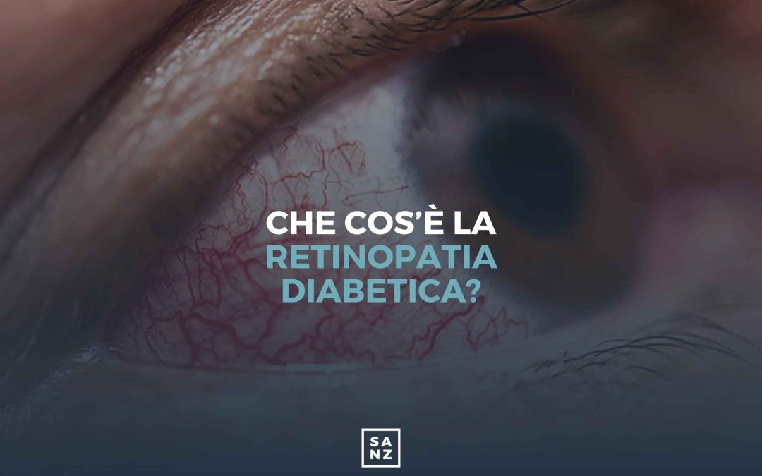 Diabete e salute oculare: che cos’è la retinopatia?